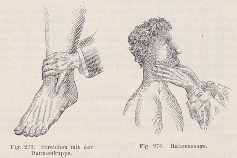 023_Schilling_1897_p242_Massage_Therapie