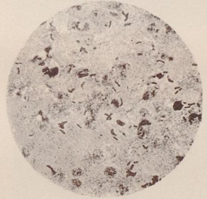 108_Ermengem_1886_TafII_Bakteriologie_Tuberkelbazillus_Reinkultur