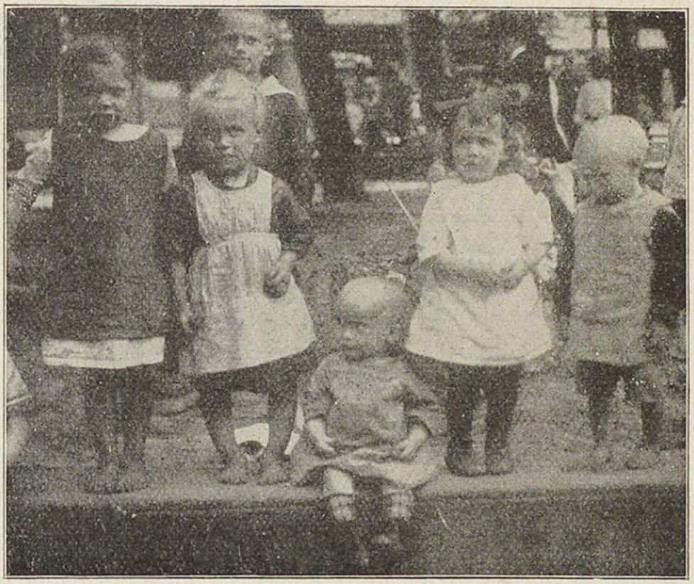 06_Das Buch fuer Alle_57_1922_H01_p14_Kinder_Koerper_Rachitis_Berlin