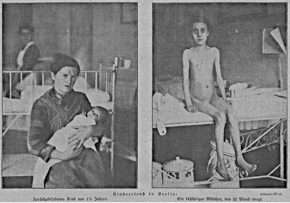 11_Zeitbilder_1920_03_13_Nr10_p2_Hungerblockade_Unterernaehrung_Kinder_Körper_Saeugling