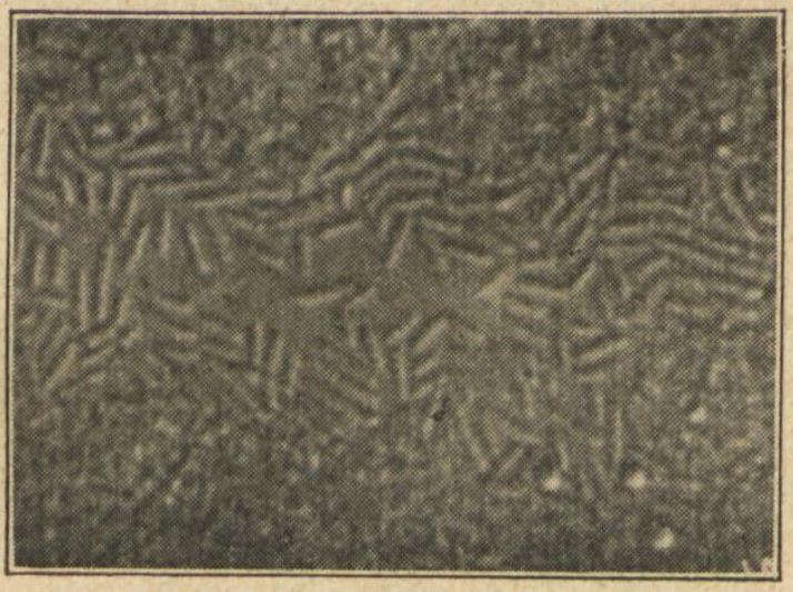 04_Damm_1929_p1129_Bacillus acidophilus_Bakterien