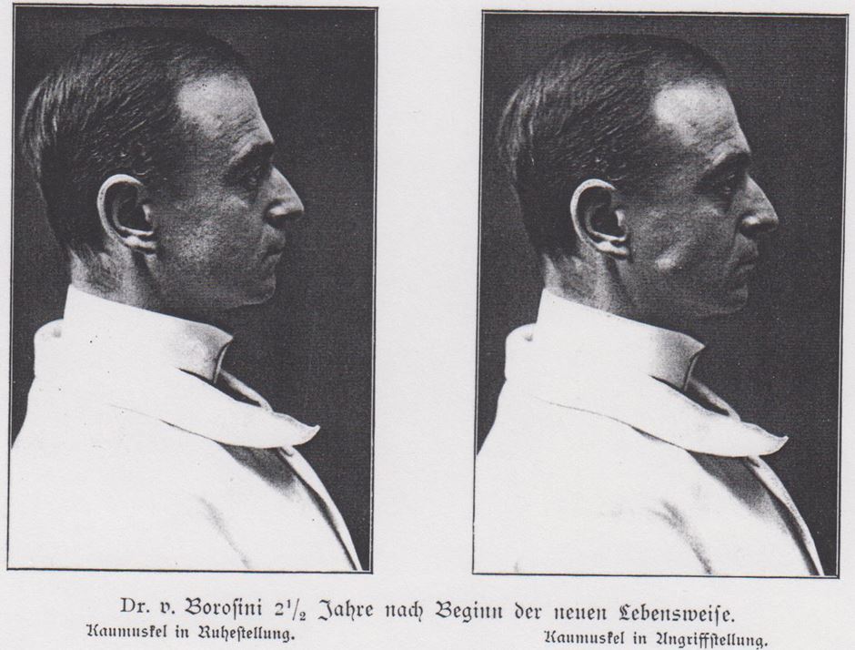 04_Borosini_1912_np192_August-von-Borosini_Kauen_Fletchern