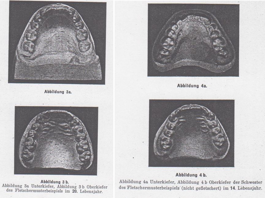 10_Forrog-Blaetter_01_1934-35_Sp072_Sp073_Gebiss_Kauen_Fletchern