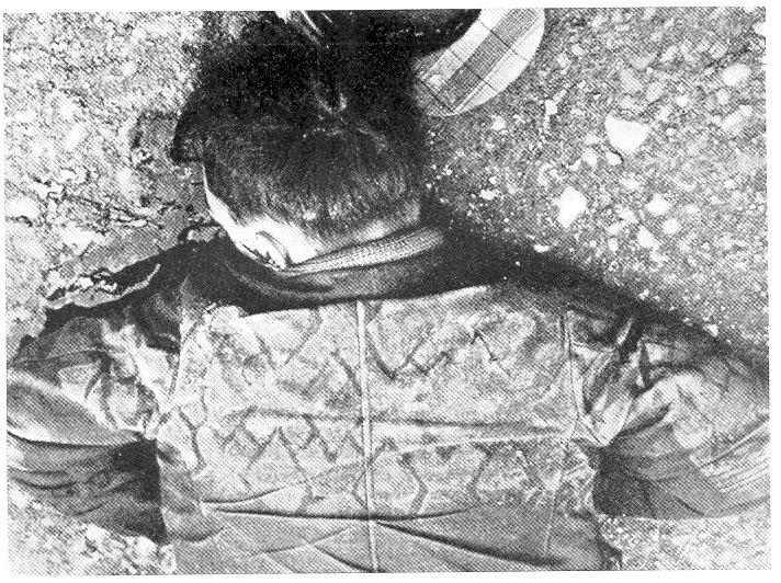 10_Buhtz_1938_p139_Verkehrstoter_Alkohol-am-Steuer_Fussgaenger